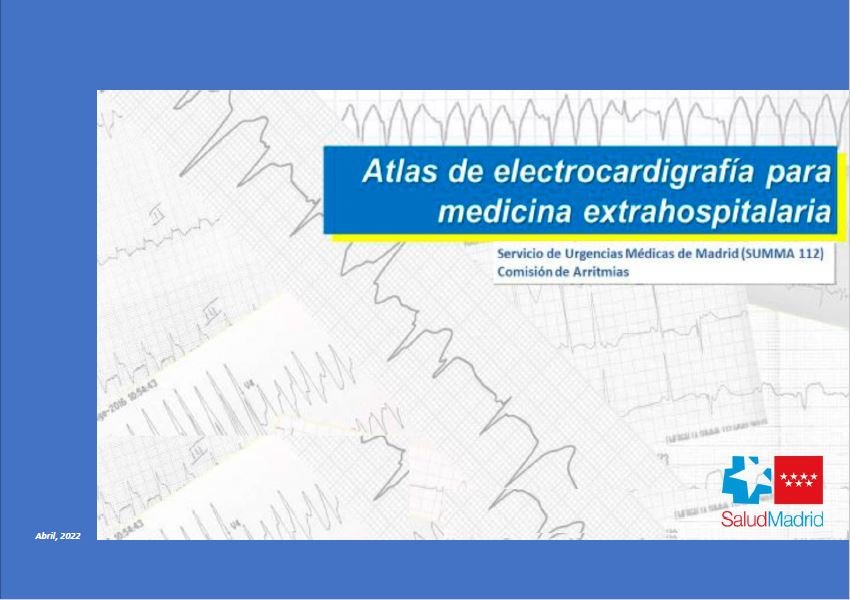 Atlas de electrocardiografía Summa 112